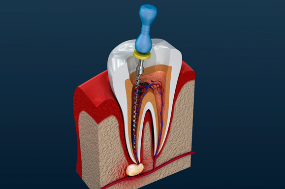 Clínica de Endodontia - Curitiba - PR